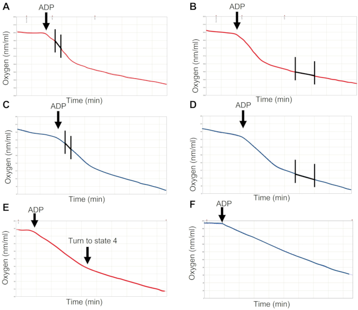 Oxygen consumption graph post-ADP addition in mitochondrial respiration; data analysis, line chart.