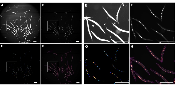 Microscopy images, C. elegans study, fluorescence, and neural activity tracking in eight panels.