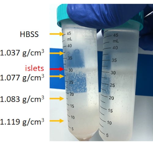figure-results-4 Density gradient centrifugation process, islet separation; laboratory experiment setup.
