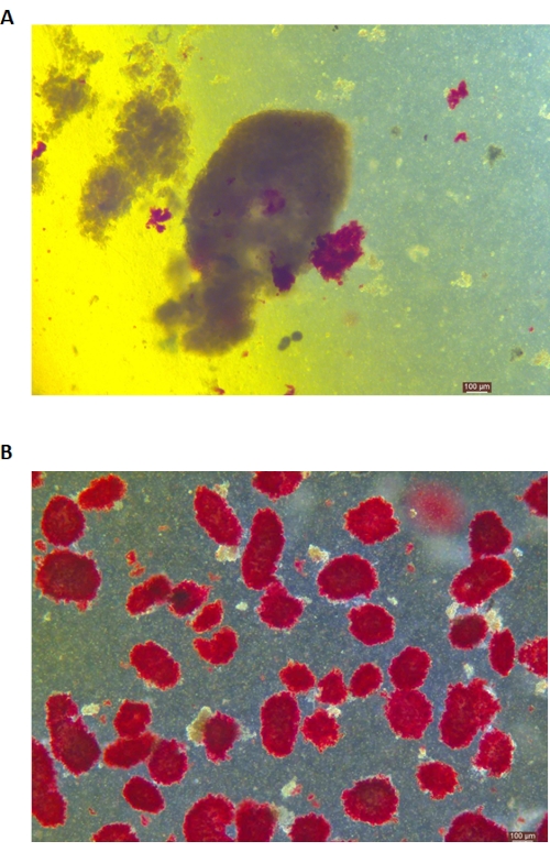 figure-results-5 Microscope image of red-stained cells, used in cell biology for structure analysis, 100µm scale.