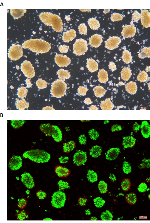 figure-results-6 Microscopy images of cellular aggregates; brightfield (A) and fluorescence (B) showing cell viability.