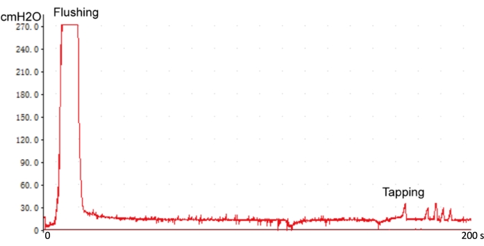 figure-results-4 Flushing and tapping pressure change graph; illustrates cmH2O over time for experimental analysis.