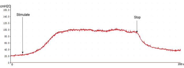 figure-results-5 Pressure vs. Time graph; stimulation effect on respiratory pressure; data analysis; cmH2O vs. seconds.