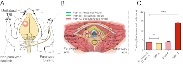 Unilateral TBI effect on nerves; path diagram, nerve length data; sectioned C7 nerve routes.