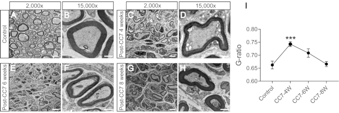 Microscopy analysis of nerve fibers at varying magnifications, with G-ratio data chart for evaluation.