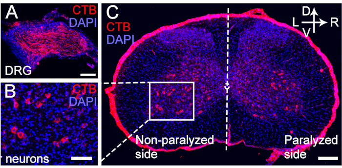 Neural tissue diagram with CTB and DAPI staining; paralysis analysis, neuron connectivity.