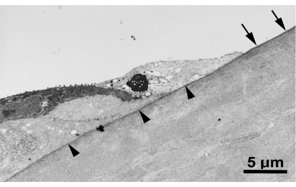 Cell membrane structure, electron microscope image showing layers and microvilli at 5 µm scale.
