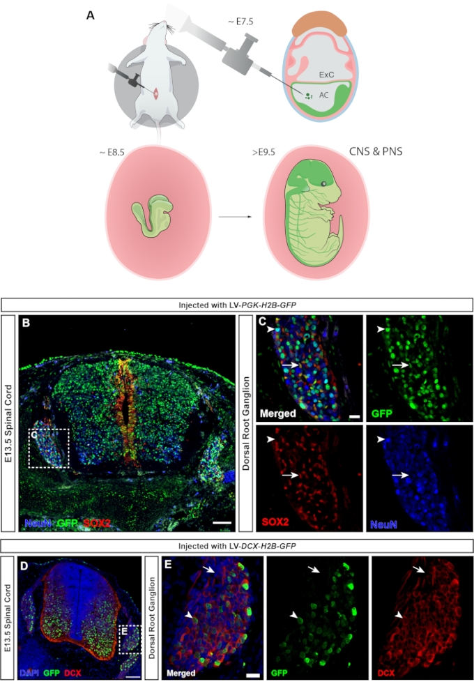 figure-results-3 Mouse neural development, injection diagram, spinal cord analysis, GFP, SOX2, DCX expression, E13.5.
