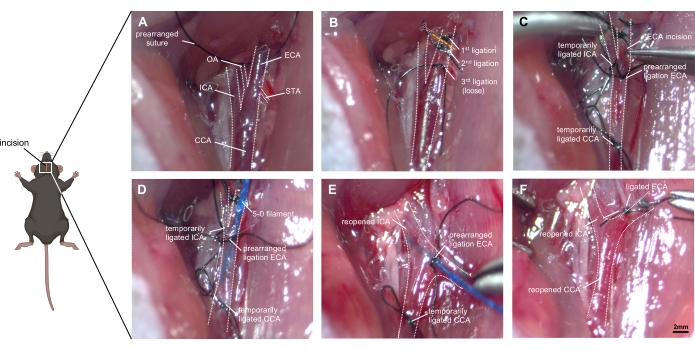 Mouse surgical procedure diagram; steps showing artery ligation and incision for research purposes.