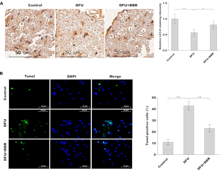 figure-results-2 Histological analysis: LC3-II staining, TUNEL assay; control vs. DFU, DFU+BBR; microscopy images.
