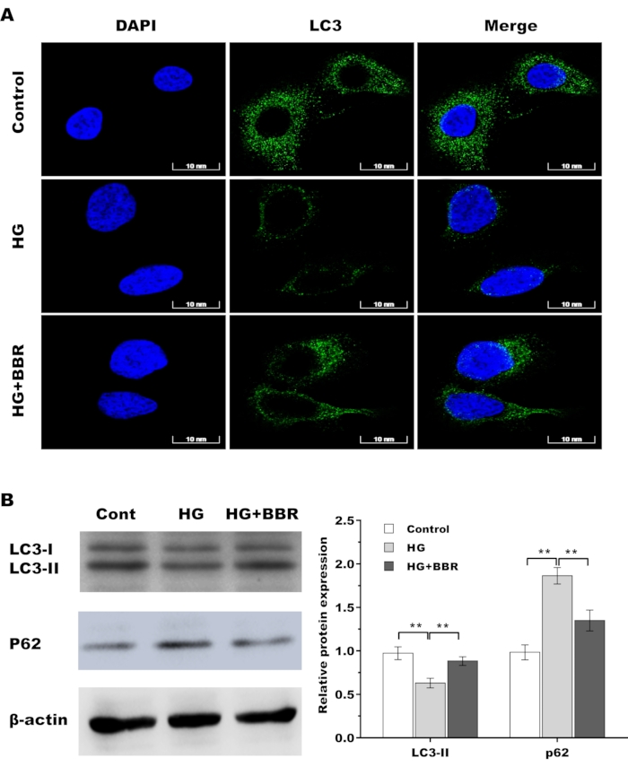 figure-results-5 Cell autophagy analysis; DAPI, LC3 fluorescence; protein expression by Western blot; result chart.