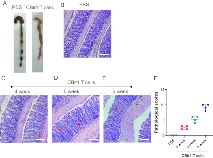 Histology and pathology analysis of intestines; T cell impact on tissue, microscopic slides, data chart.