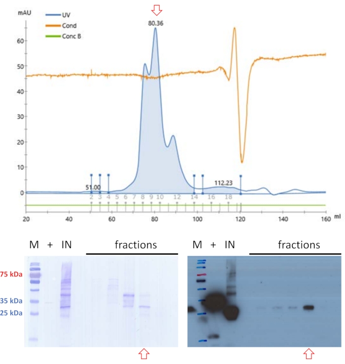 Chromatography results and electrophoresis diagram; protein purification; UV/Cond/ConcB peaks visible.