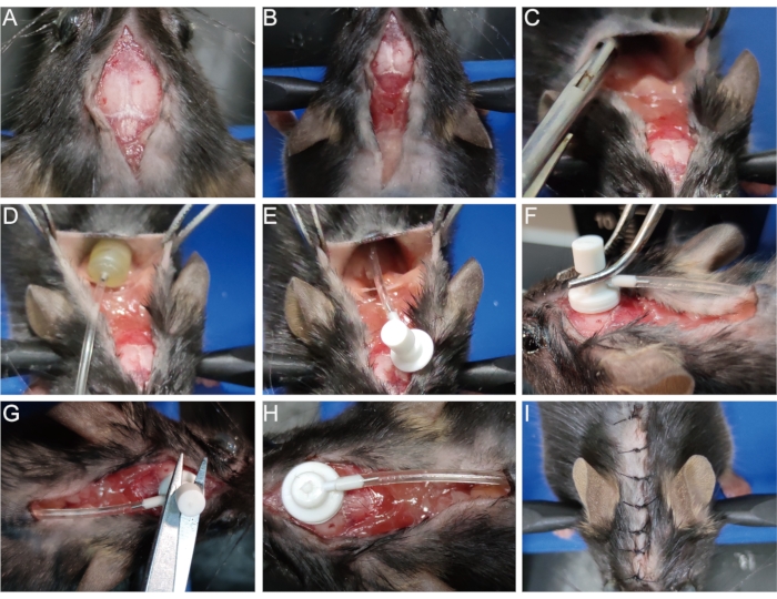Surgical implantation process, steps A-I, mouse model, device insertion, experimental setup, laboratory.