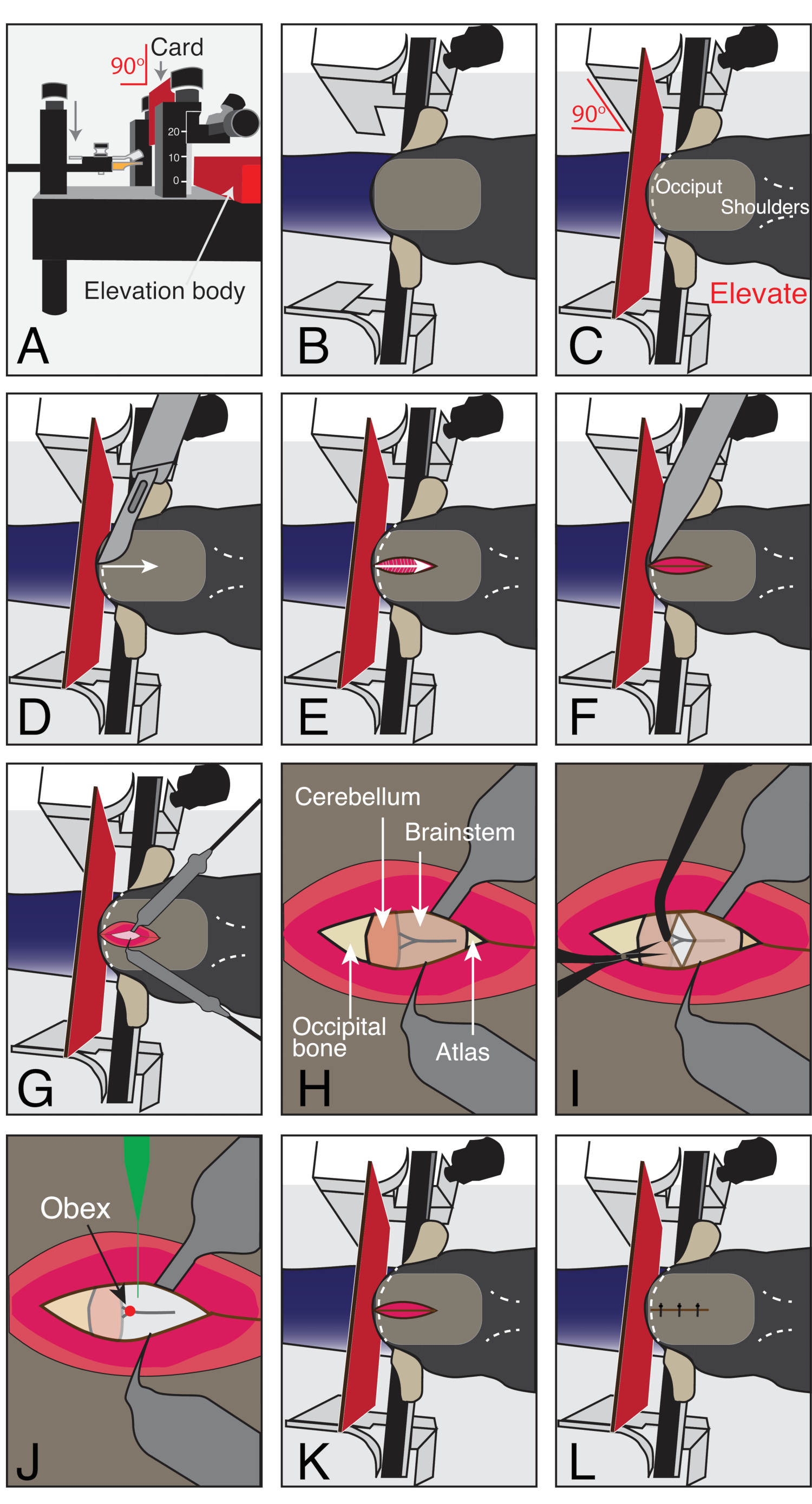 Stereotaxic Surgical Approach to Microinject the Caudal Brainstem 