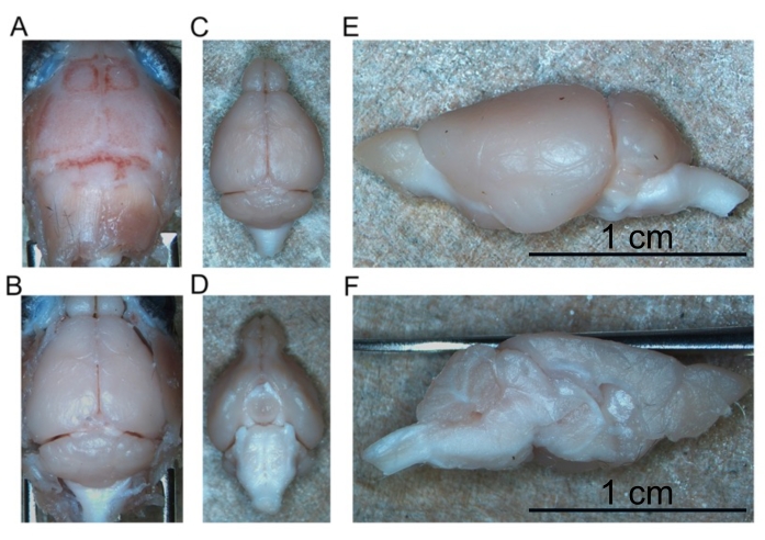 Dissection of embryonic brain; labeled samples A-F; anatomical study; scale bars 1 cm; comparison.