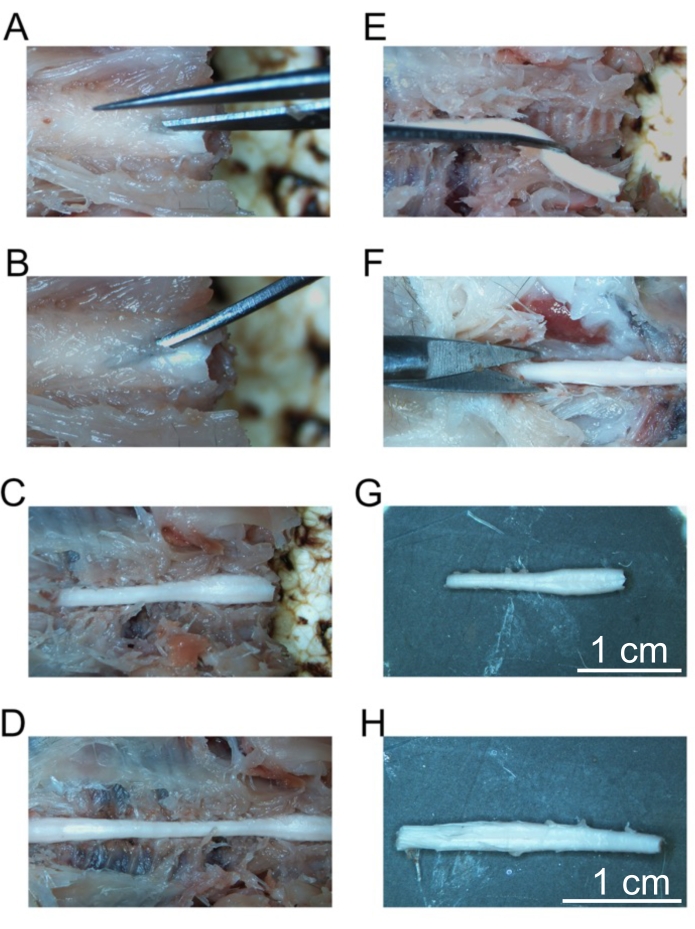 Dissection sequence showing nerve extraction process; steps labeled A-H, close-up views, scalpel use.