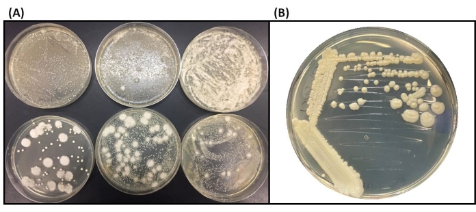 Bacterial colony growth on agar plates; experiment for microbial culture observation and analysis.