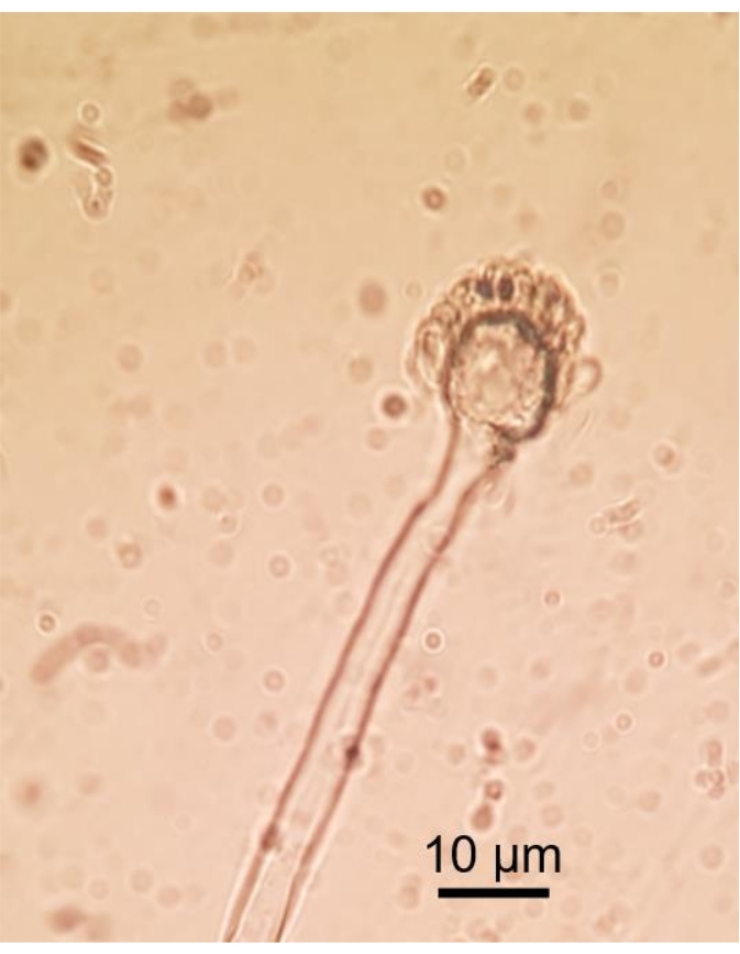 Microscopy image of mold spore; fungal structure study; magnified at 10 μm; cell morphology.