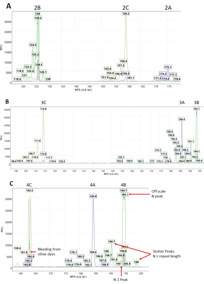 Electropherogram illustrating DNA fragments' separation, chart with peaks for length analysis.