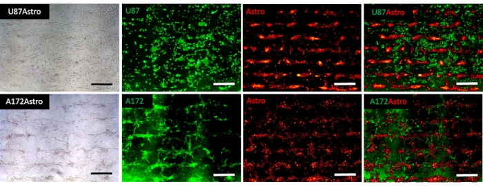 Astrocyte and tumor cell interaction; immunofluorescence images; green and red markers, microscopy analysis.