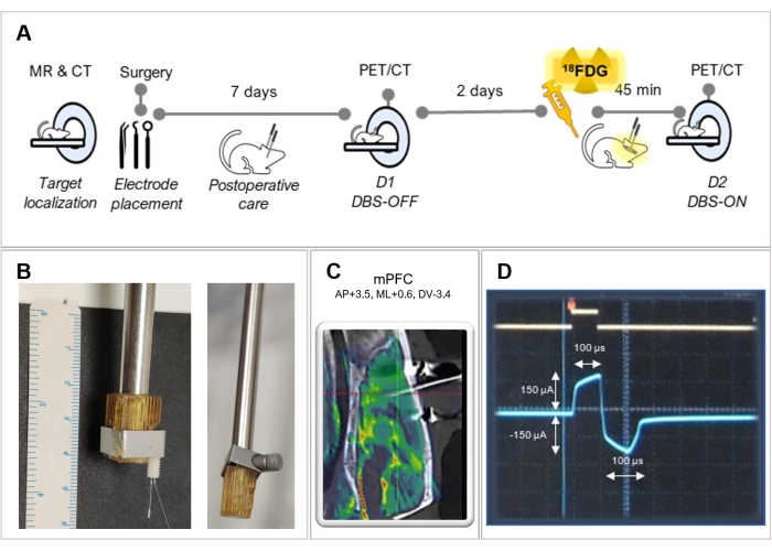 MR-CT guided DBS setup process; electrode placement; PET results; mPFC target imaging; signal graph.