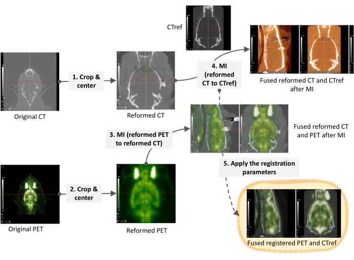 CT and PET image registration process; diagram of multiphase alignment using mutual information.