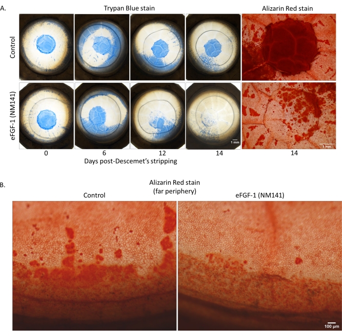 figure-results-3 Corneal healing stages; Trypan Blue and Alizarin Red stains; microscopy; Descemet's stripping.