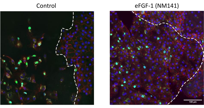 figure-results-4 Fluorescence microscopy results of cell proliferation; control vs. eFGF-1 (NM141) treated samples.