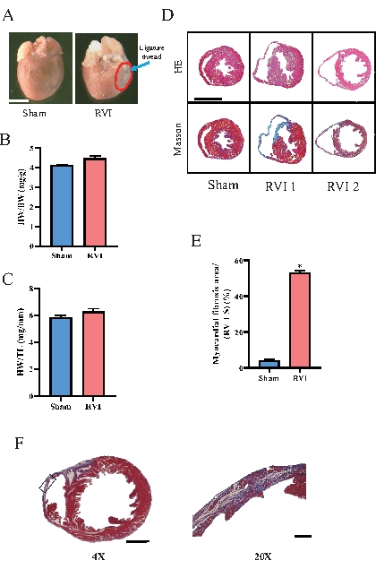 Generation and Characterization of Right Ventricular Myocardial ...
