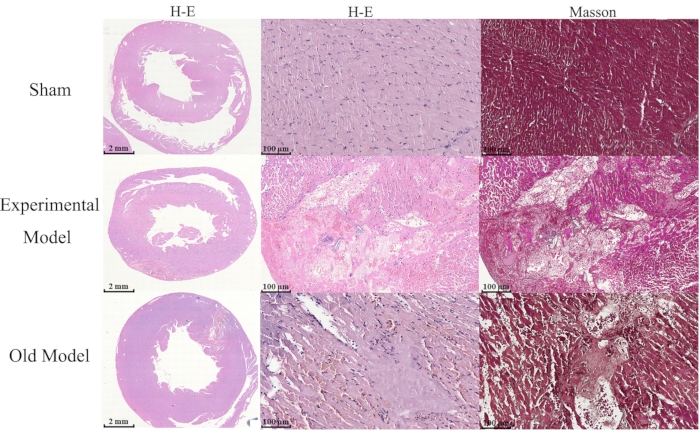 Histological analysis chart; H-E and Masson staining; heart tissue comparison: sham, experimental, old models.