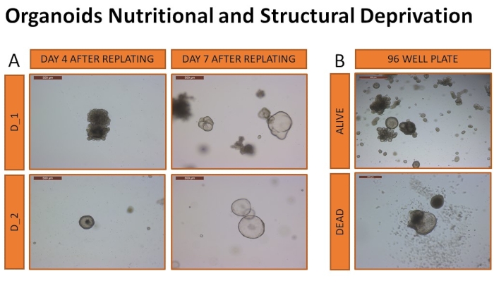 figure-results-4 Organoid deprivation effects; microscope images; time-lapse comparison; nutritional variables; assay results.