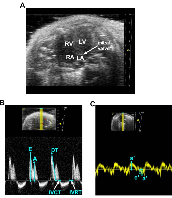 figure-results-4 Ultrasound diagram with cardiac Doppler analysis, showcasing heart chambers and mitral valve function.