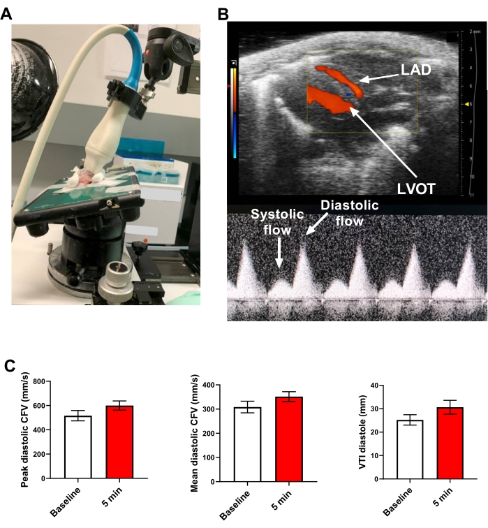 figure-results-5 Cardiovascular ultrasound analysis; Doppler flow, LAD, LVOT; bar graphs of diastolic flow metrics.