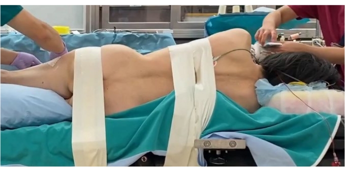 figure-protocol-2 Patient on operating table during medical procedure; clinical setting, medical equipment present.