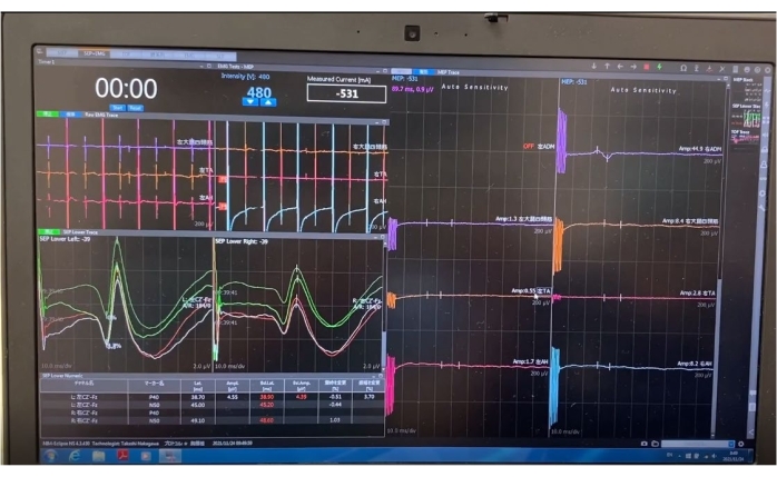 figure-protocol-3 Cardiac waveform analysis graph on a monitor; electrophysiology research data visualization.