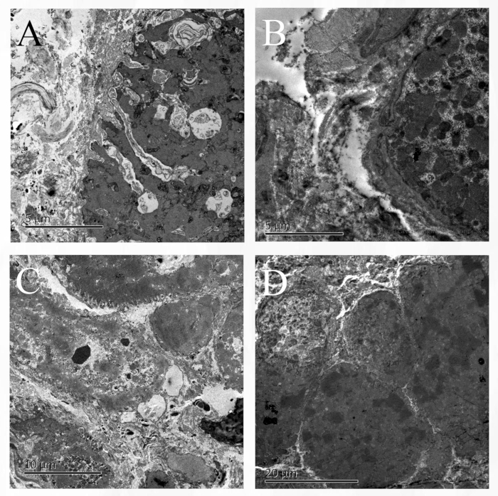 figure-results-7 Electron microscopy images of cellular structures; detail analysis at 5-20μm scale.