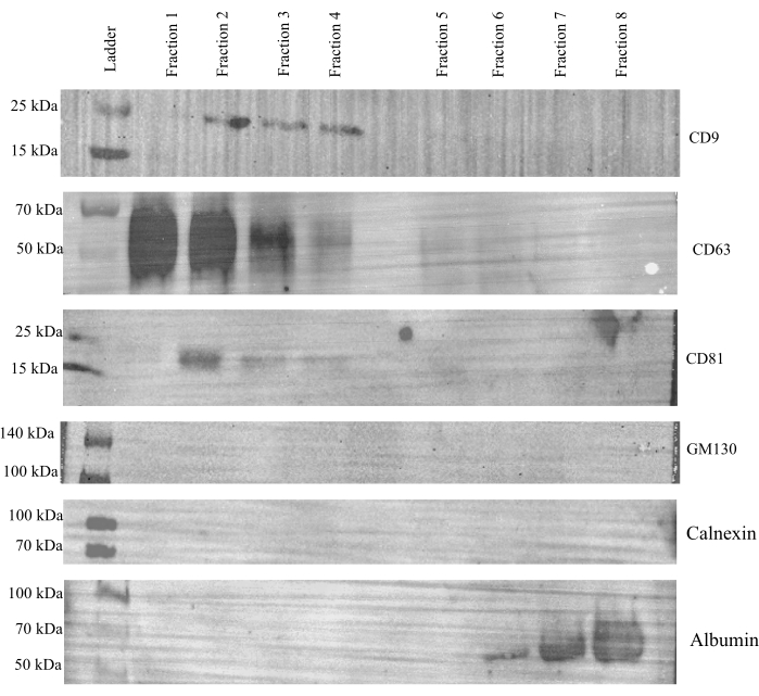Western blot protein fractionation; CD9, CD63, CD81 bands; molecular weight markers; experiment.