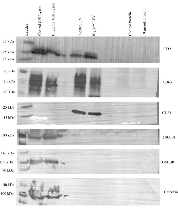 Western blot analysis of protein markers CD9, CD63, CD81, TSG101, GM130, Calnexin; band intensity.