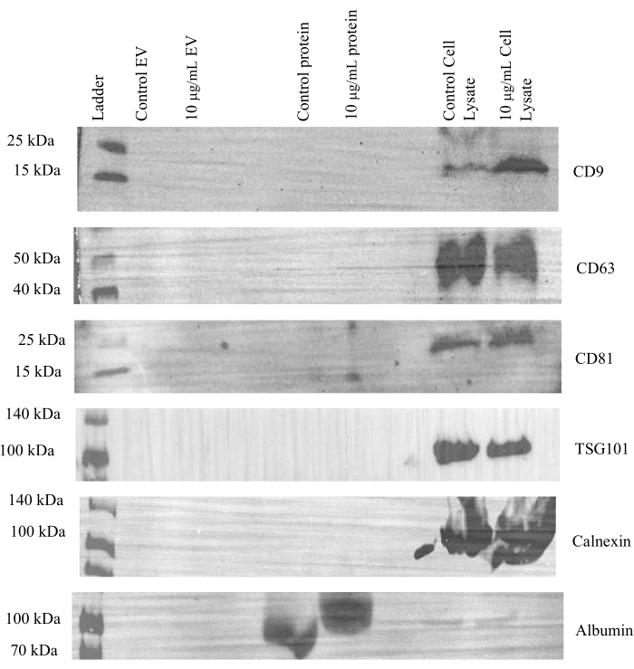 Western blot analysis; protein bands of CD9, CD63, CD81, TSG101, Calnexin, and Albumin are shown.