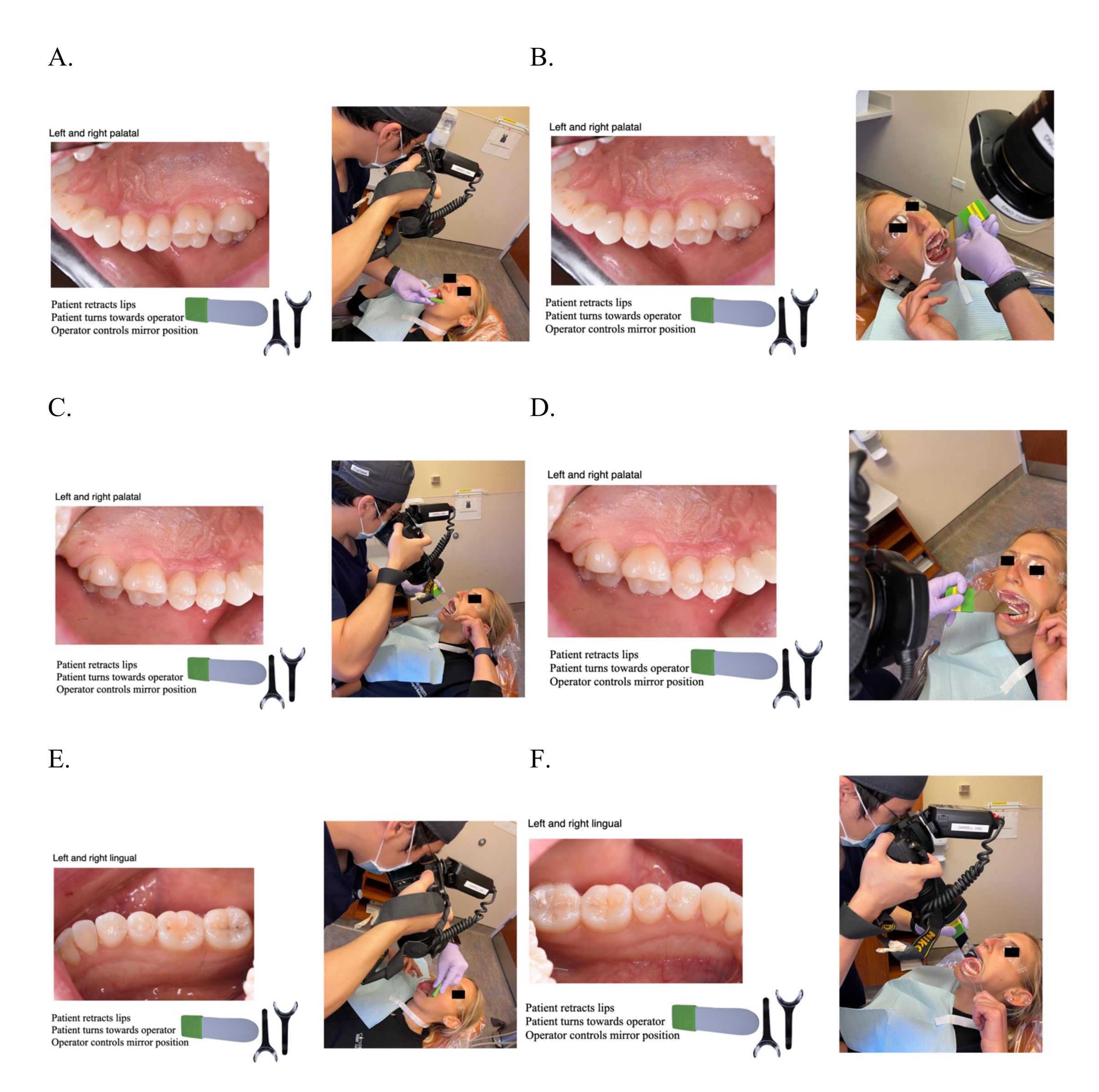 Miroir de photographie de clinique dentaire intra-orale