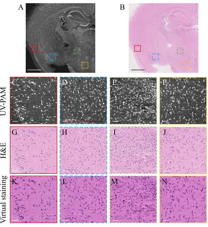 UV-PAM and H&E brain tissue comparison; diagram shows histological analysis through virtual staining.