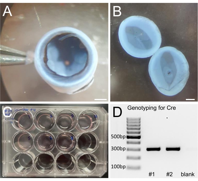 Embryo dissection, cultured in multiwell plate; DNA analysis by genotyping gel electrophoresis.