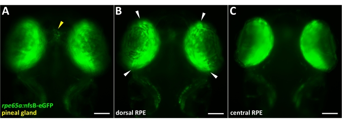 figure-results-1 Fluorescent microscopy images; GFP expression in zebrafish pineal gland and retinal pigment epithelium.
