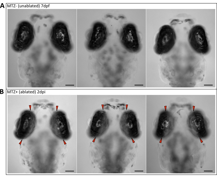 figure-results-2 Zebrafish brain ablation study, microscopy images compare control vs. MTZ-treated neural tissue.