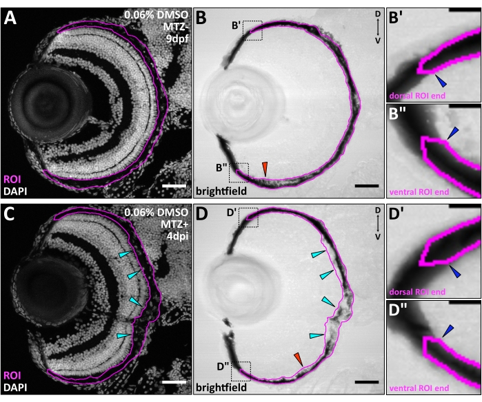 figure-results-3 Zebrafish retina development analysis; DAPI stain, brightfield imaging; ROI, structural comparison.