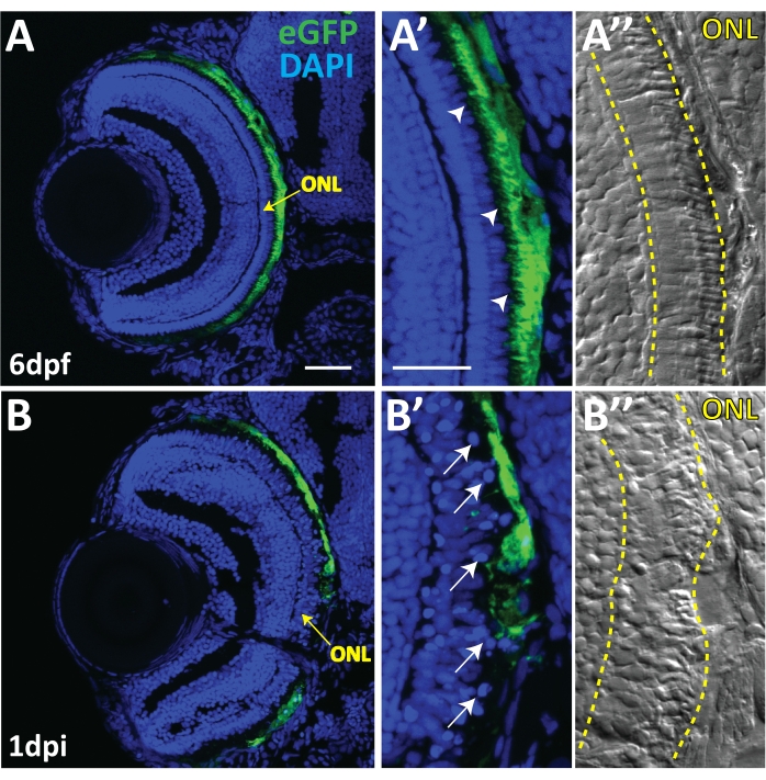 figure-results-5 Cross-sectional retinal microscopy showing eGFP/DAPI with ONL labeling in zebrafish eye development.
