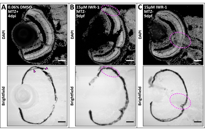 figure-results-7 DAPI labeled zebrafish brain sections in brightfield, analyzing effect of MTZ, IWR-1 treatment.