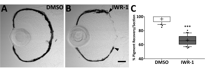 figure-results-8 Histological sections with DMSO and IWR-1; pigment recovery graph comparison; experimental results.