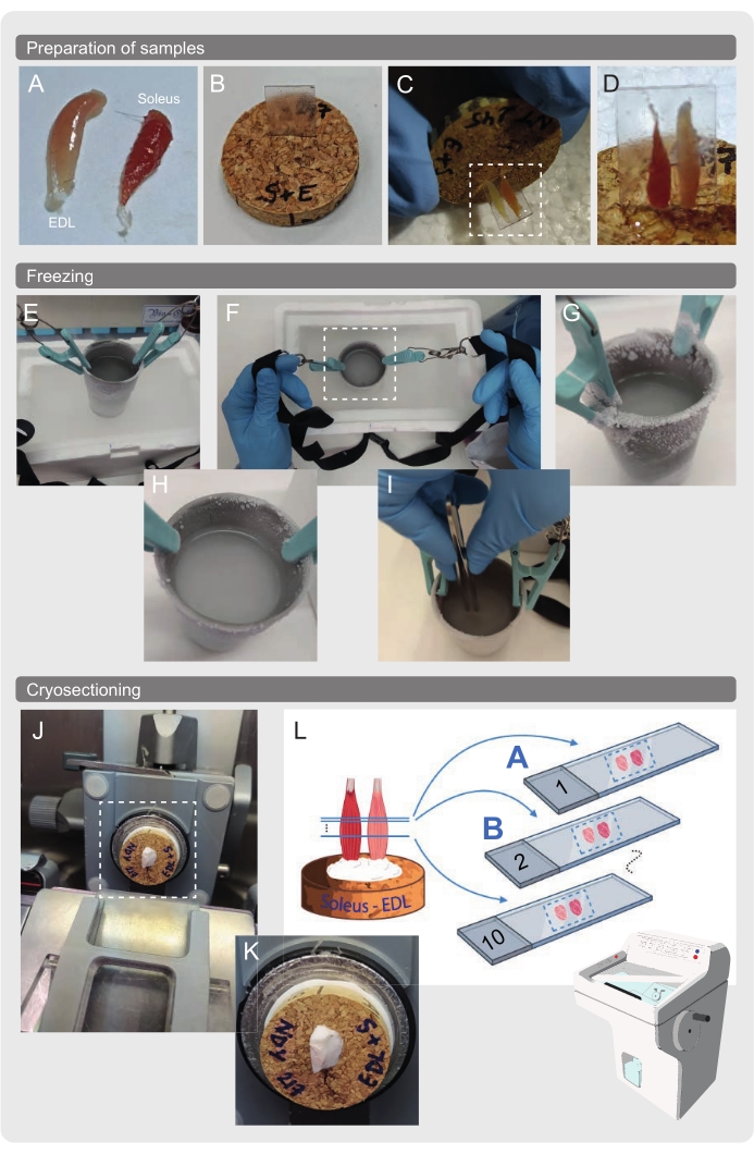 Cryosection Sample Fiber Type and Subcellular-Specific Analysis of Lipid Droplet Content ...